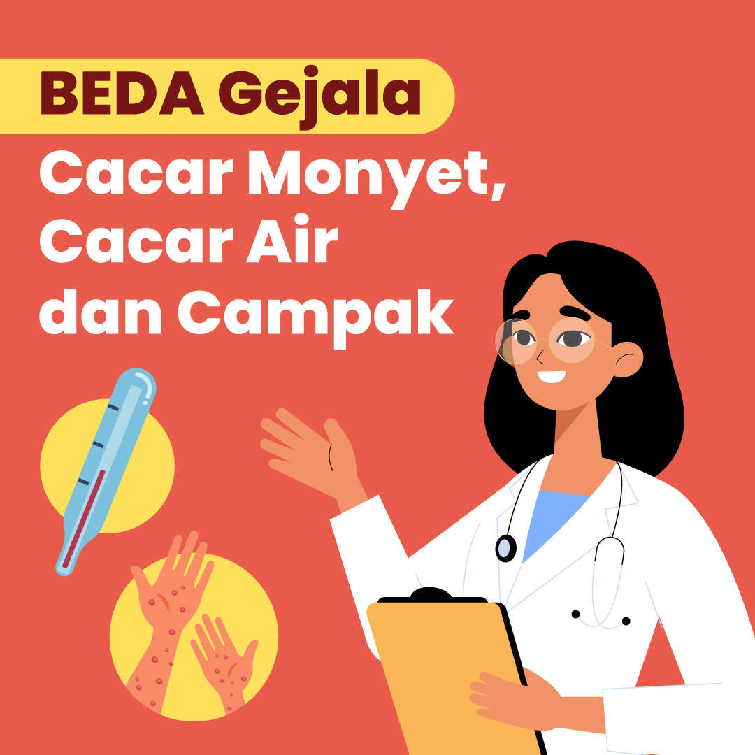 BEDA Gejala Cacar Monyet, Cacar Air dan Campak