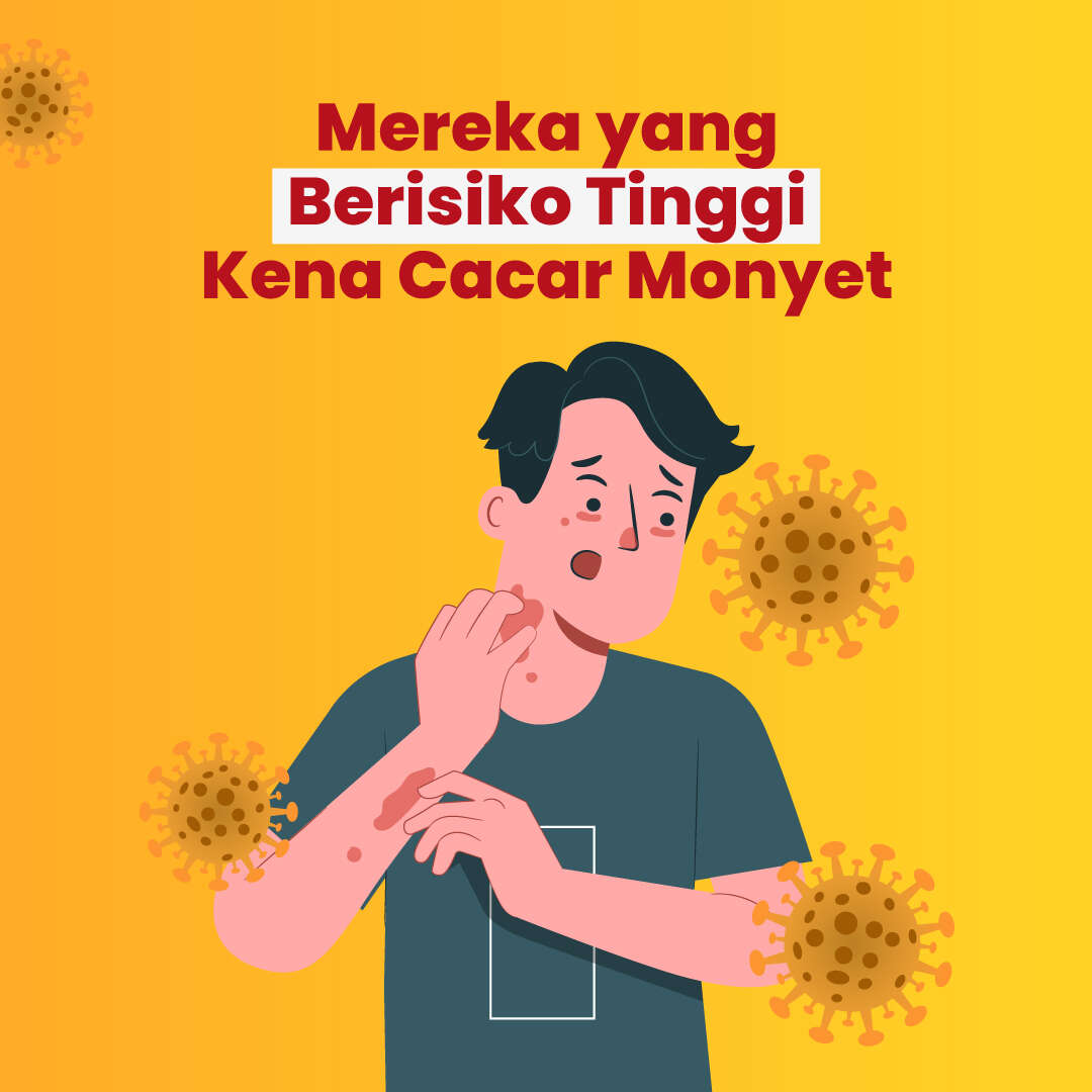 Mereka yang Berisiko Tinggi Kena Cacar Monyet